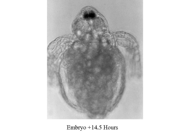 Embryo +14. 5 Hours 