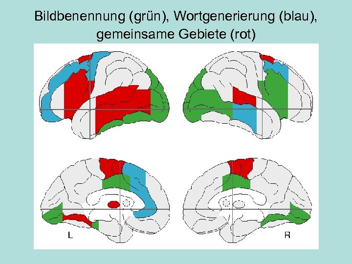 Bildbenennung (grün), Wortgenerierung (blau), gemeinsame Gebiete (rot) 