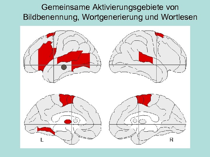 Gemeinsame Aktivierungsgebiete von Bildbenennung, Wortgenerierung und Wortlesen 