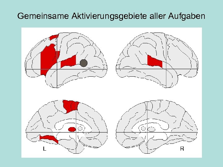 Gemeinsame Aktivierungsgebiete aller Aufgaben 