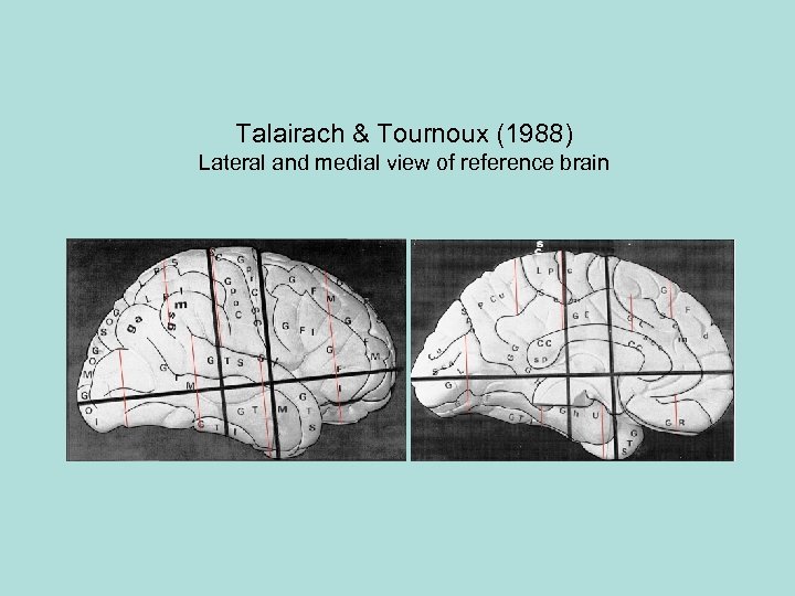 Talairach & Tournoux (1988) Lateral and medial view of reference brain 