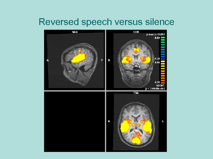 Reversed speech versus silence 