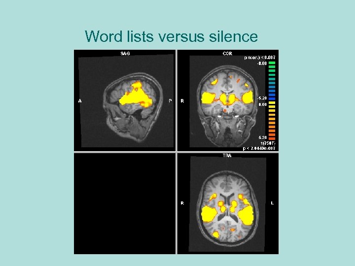 Word lists versus silence 