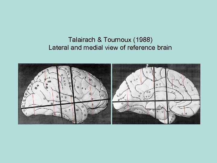 Talairach & Tournoux (1988) Lateral and medial view of reference brain 