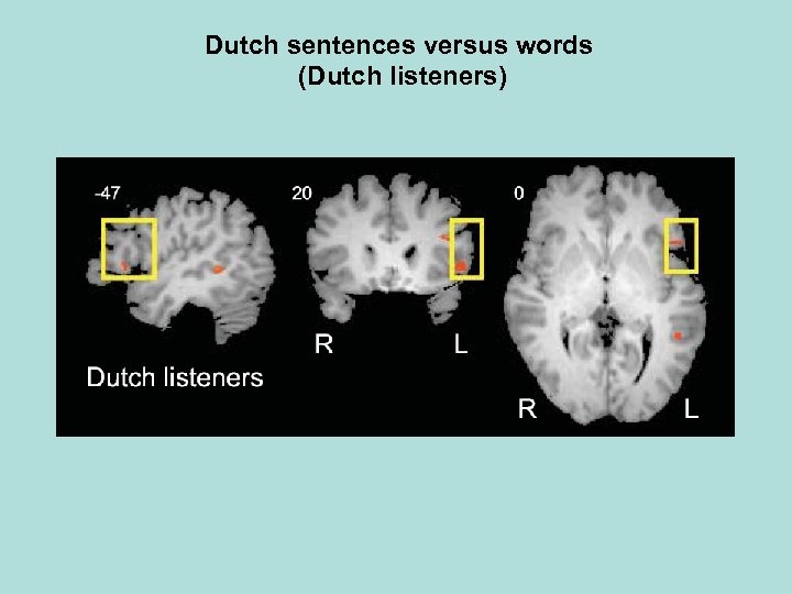 Dutch sentences versus words (Dutch listeners) 