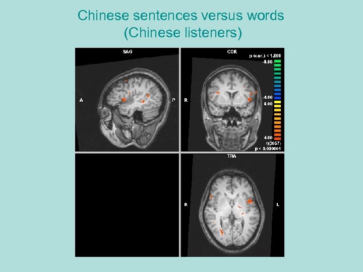 Chinese sentences versus words (Chinese listeners) 