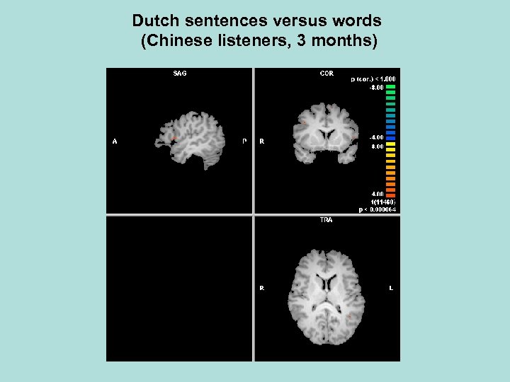 Dutch sentences versus words (Chinese listeners, 3 months) 