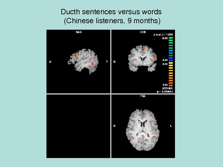 Ducth sentences versus words (Chinese listeners, 9 months) 