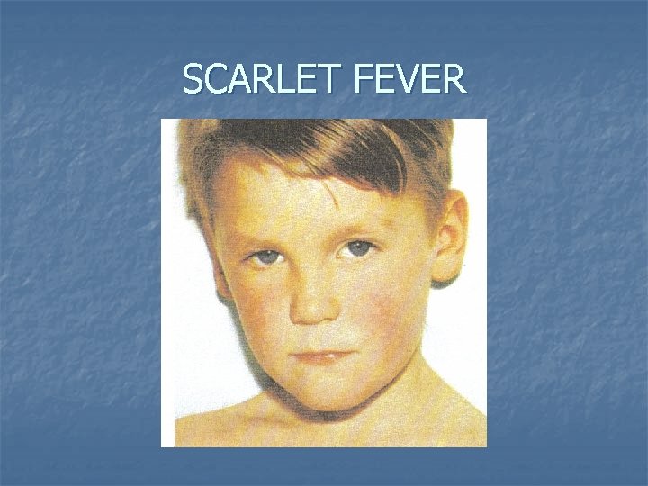 SCARLET FEVER 