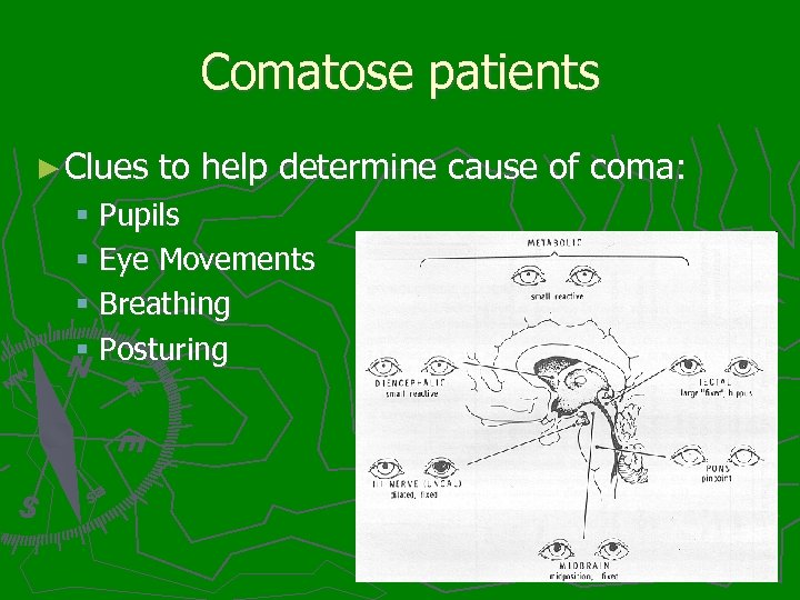 Comatose patients ► Clues to help determine cause of coma: § Pupils § Eye