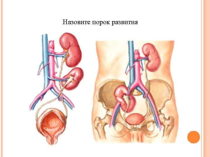 Назовите порок развития 