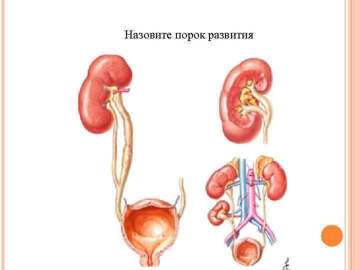 Назовите порок развития 