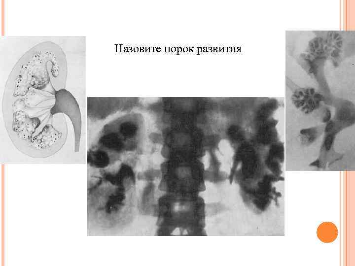 Назовите порок развития 