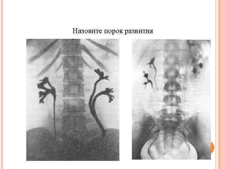 Назовите порок развития 