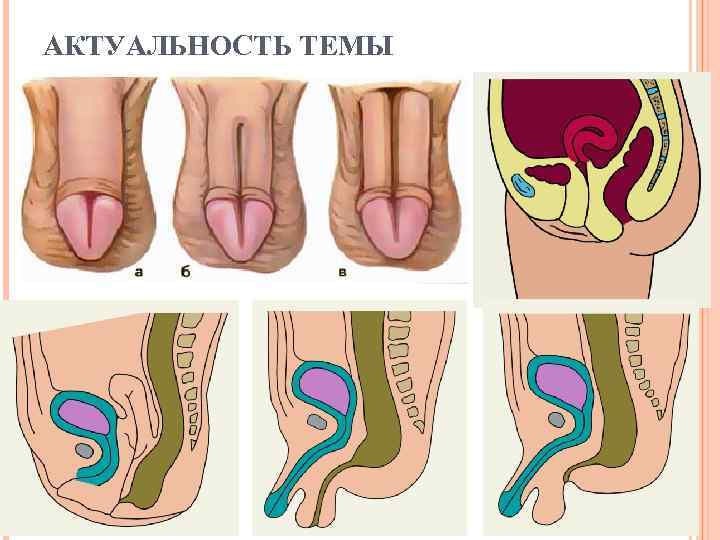 АКТУАЛЬНОСТЬ ТЕМЫ 