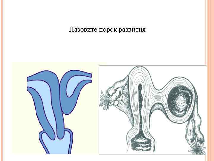 Назовите порок развития 