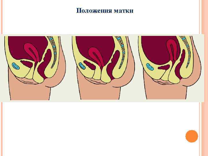 Положения матки 