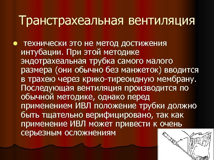 Транстрахеальная вентиляция l технически это не метод достижения интубации. При этой методике эндотрахеальная трубка