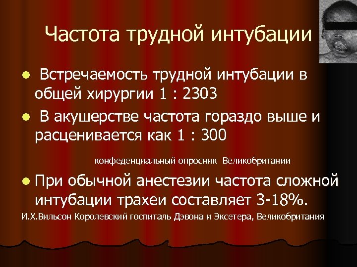 Частота трудной интубации Встречаемость трудной интубации в общей хирургии 1 : 2303 l В