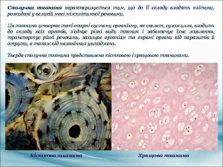 Сполучна тканина характеризується тим, що до її складу входять клітини, розкидані у великій масі