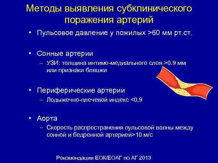 Методы выявления субклинического поражения артерий • Пульсовое давление у пожилых >60 мм рт. ст.