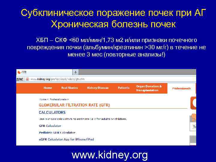 Субклиническое поражение почек при АГ Хроническая болезнь почек ХБП – СКФ <60 мл/мин/1, 73