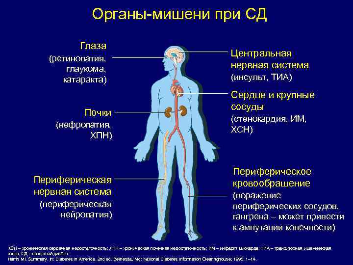 Органы-мишени при СД Глаза (ретинопатия, глаукома, катаракта) Почки (нефропатия, ХПН) Периферическая нервная система (периферическая