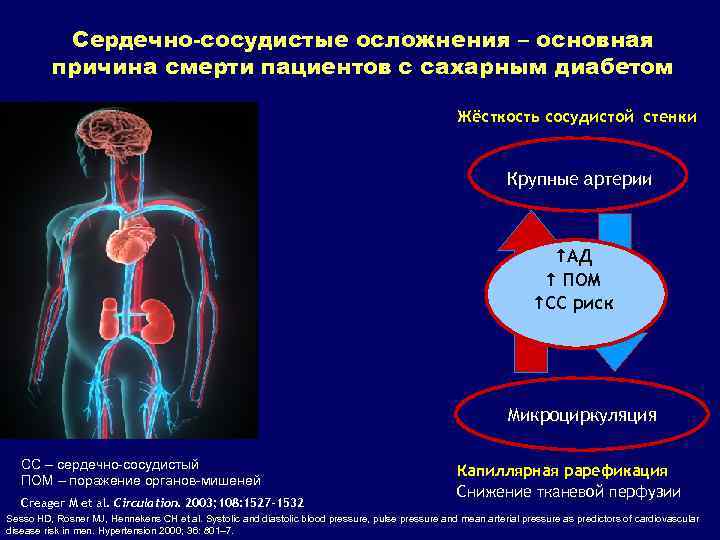 Сердечно-сосудистые осложнения – основная причина смерти пациентов с сахарным диабетом Жёсткость сосудистой стенки Крупные