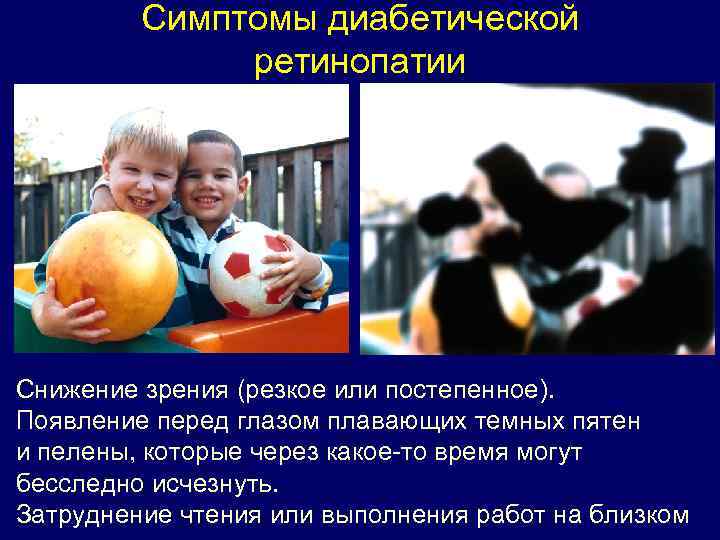 Симптомы диабетической ретинопатии Снижение зрения (резкое или постепенное). Появление перед глазом плавающих темных пятен