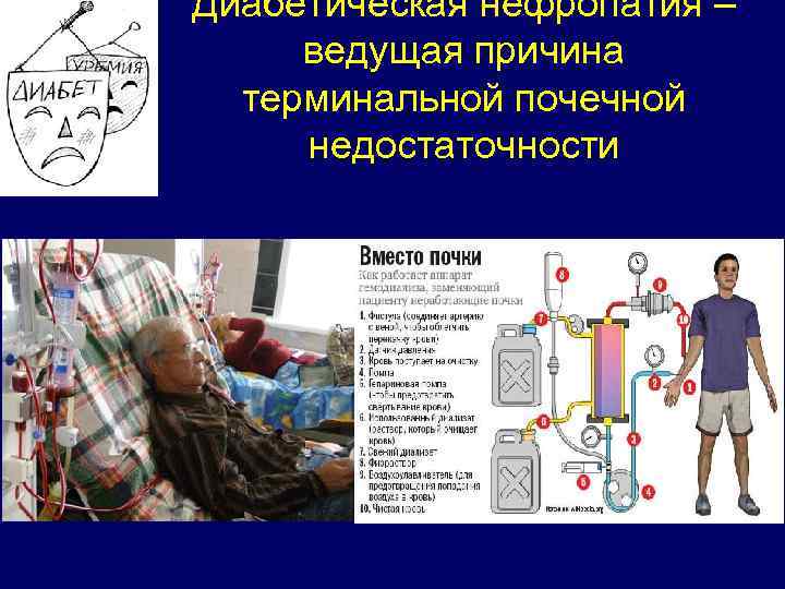Диабетическая нефропатия – ведущая причина терминальной почечной недостаточности 