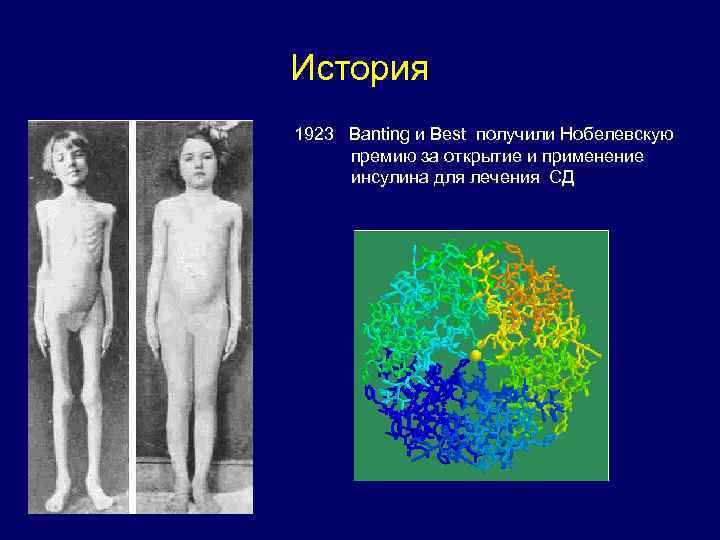 История 1923 Banting и Best получили Нобелевскую премию за открытие и применение инсулина для