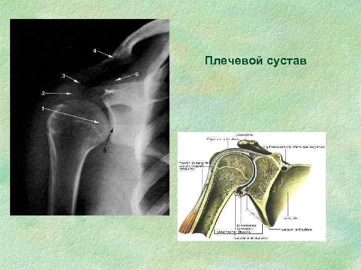 Плечевой сустав 