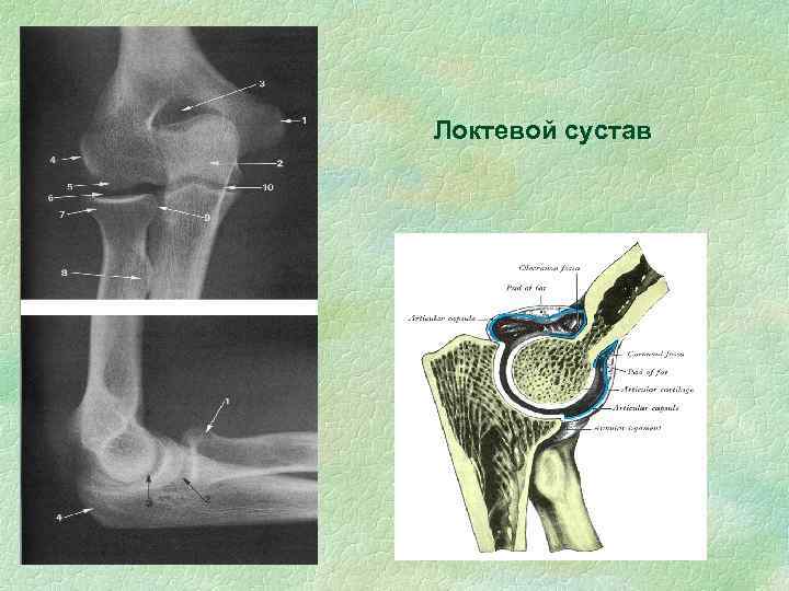 Локтевой сустав 