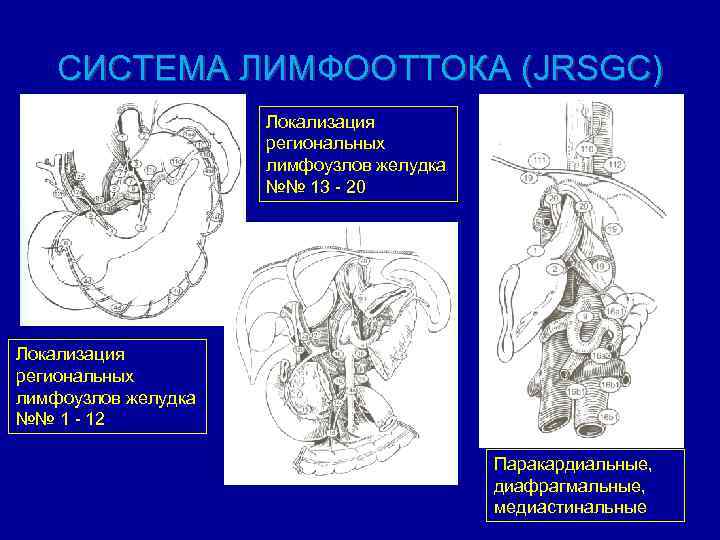СИСТЕМА ЛИМФООТТОКА (JRSGC) Локализация региональных лимфоузлов желудка №№ 13 - 20 Локализация региональных лимфоузлов