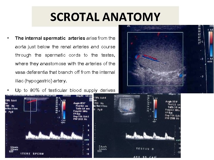 SCROTAL ANATOMY • The internal spermatic arteries arise from the aorta just below the