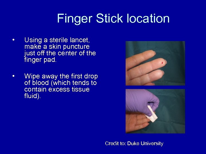 Finger Stick location • Using a sterile lancet, make a skin puncture just off