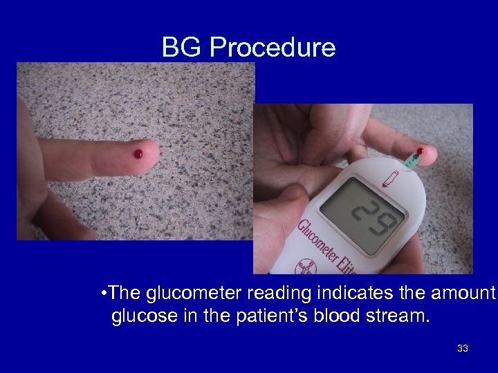 BG Procedure • The glucometer reading indicates the amount glucose in the patient’s blood