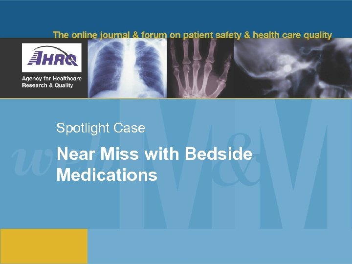 Spotlight Case Near Miss with Bedside Medications 