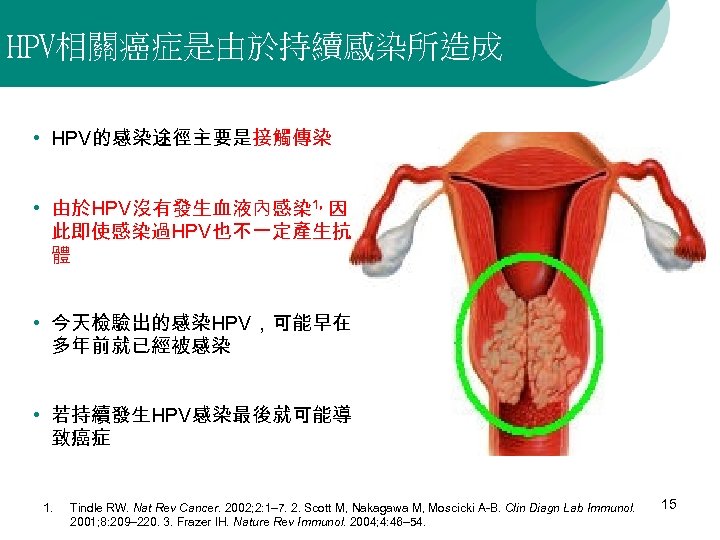 HPV相關癌症是由於持續感染所造成 • HPV的感染途徑主要是接觸傳染 • 由於HPV沒有發生血液內感染 1，因 此即使感染過HPV也不一定產生抗 體 • 今天檢驗出的感染HPV，可能早在 多年前就已經被感染 • 若持續發生HPV感染最後就可能導 致癌症