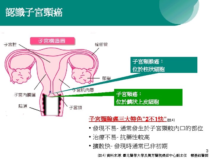 認識子宮頸癌 子宮頸腺癌： 位於柱狀細胞 子宮頸癌： 位於鱗狀上皮細胞 子宮頸腺癌三大特色” 2不1快”(註 4) • 發現不易- 通常發生於子宮頸較內口的部位 • 治療不易- 抗藥性較高