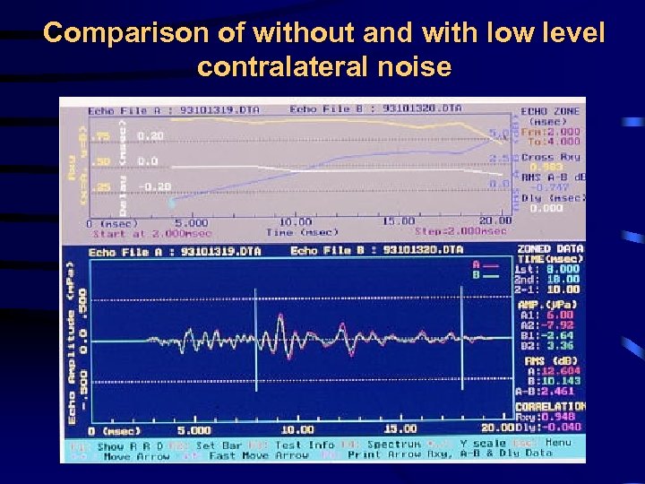 Comparison of without and with low level contralateral noise 