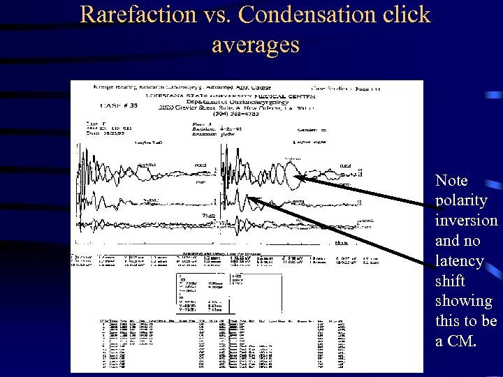 Rarefaction vs. Condensation click averages Note polarity inversion and no latency shift showing this