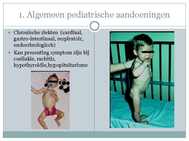 1. Algemeen pediatrische aandoeningen Chronische ziekten (cardiaal, gastro-intestinaal, respiratoir, endocrinologisch) Kan presenting symptom zijn