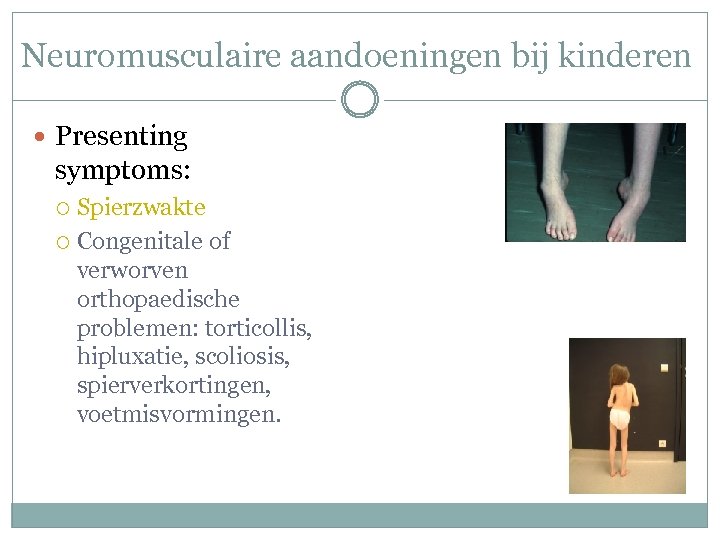 Neuromusculaire aandoeningen bij kinderen Presenting symptoms: Spierzwakte Congenitale of verworven orthopaedische problemen: torticollis, hipluxatie,