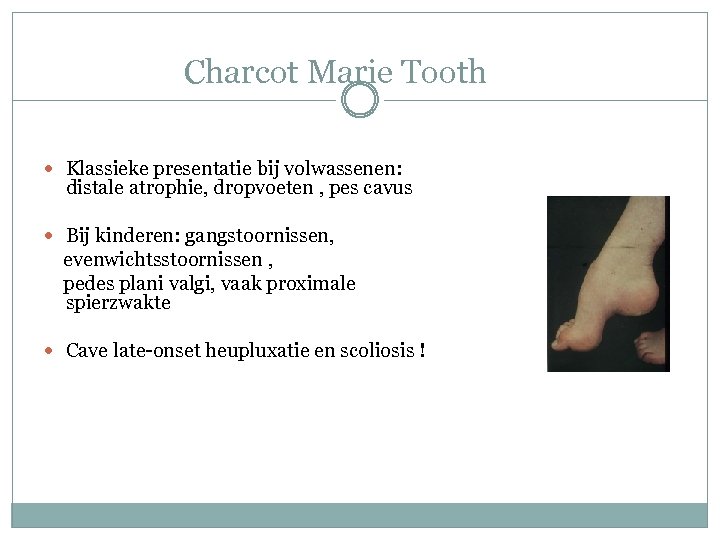 Charcot Marie Tooth Klassieke presentatie bij volwassenen: distale atrophie, dropvoeten , pes cavus Bij