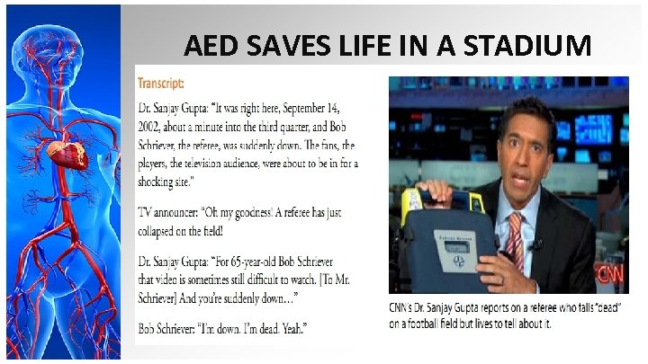 AED SAVES LIFE IN A STADIUM 