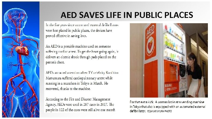 AED SAVES LIFE IN PUBLIC PLACES 