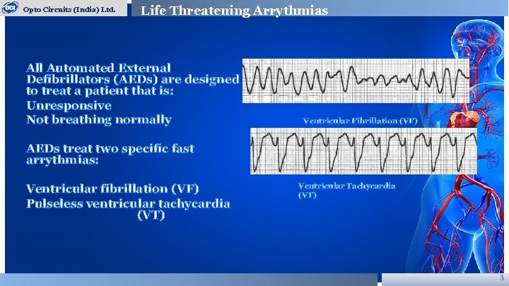 Opto Circuits (India) Ltd. Life Threatening Arrythmias All Automated External Defibrillators (AEDs) are designed
