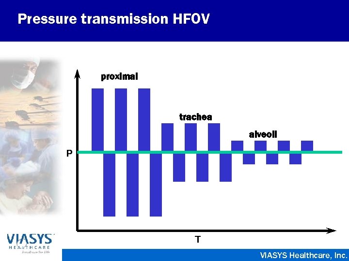 Pressure transmission HFOV proximal trachea alveoli P T VIASYS Healthcare, Inc. 