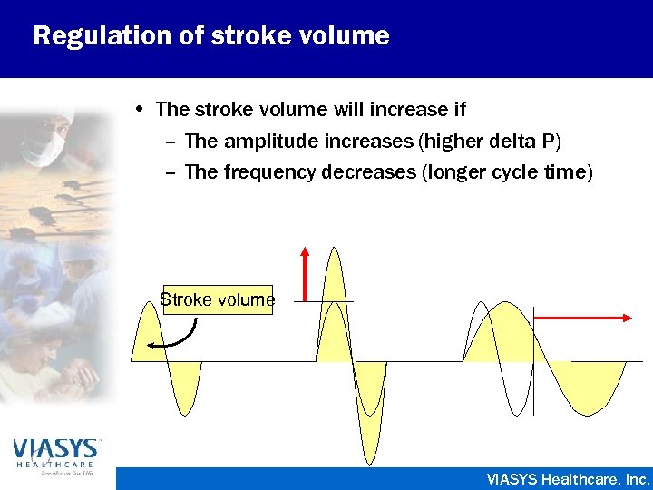 Regulation of stroke volume • The stroke volume will increase if – The amplitude